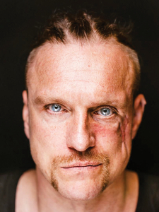 Kara rētas uz Andrija Kiceļuka sejas