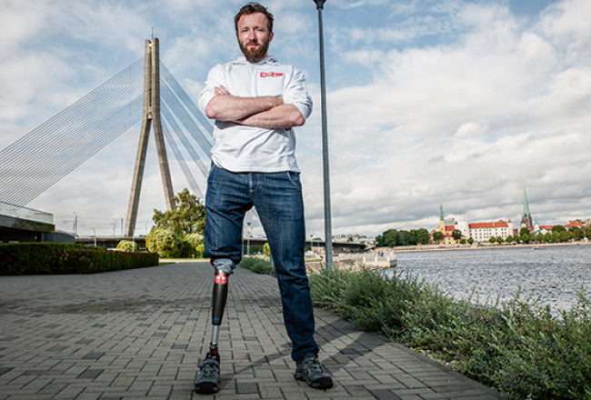 Gudrā kāja C-Leg no parastās protēzes atšķiras ar to, ka tās ceļgalā ir dators, kas saprot cilvēku un pieskaņojas solim. «Kad eju lēnām, kāja to saprot un piemērojas lēnam tempam. Kad paātrinos, piemēram, steidzos uz transportu, tad arī kāja pielāgojas,» skaidro Aleksandrs.
