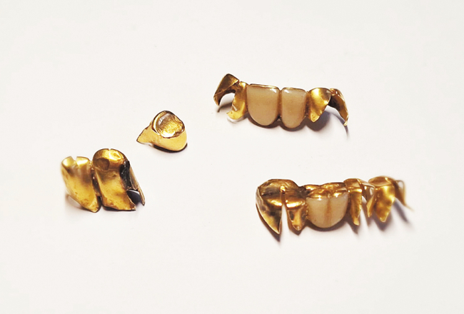 Cilvēki nereti uzskata, ka priekšgājēju zelta zobu glabāšana vairos viņu dzimtas, ģimenes spēku un bagātību. Foto — Gunita Rence
