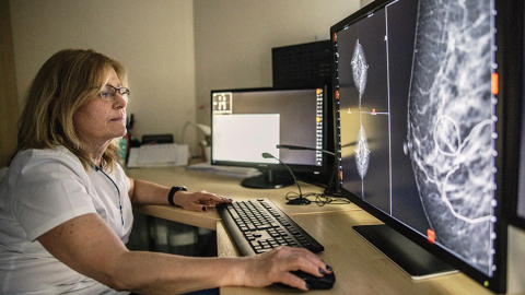Ungāru radioloģe Ēva Ambrozai izmanto mākslīgo intelektu, lai pamanītu krūts vēža aizmetņus, kurus varētu būt palaiduši garām viņas kolēģi