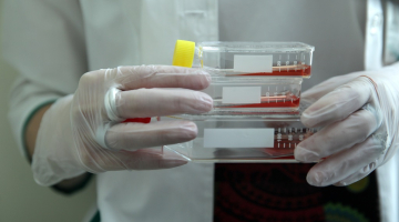 Paula Stradiņa Klīniskās universitātes slimnīcas Šūnu Transplantācijas centra Šūnu izpētes un transplantācijas laboratorija. Foto: Ieva Čīka, LETA