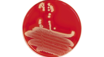 Foto — Zeltainā stafilokoka diagnostika © iStockphoto