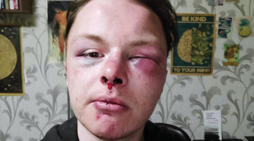 Pēc uzbrukuma.
Foto no personīgā arhīva