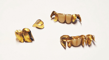 Cilvēki nereti uzskata, ka priekšgājēju zelta zobu glabāšana vairos viņu dzimtas, ģimenes spēku un bagātību. Foto — Gunita Rence