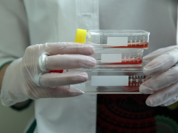 Paula Stradiņa Klīniskās universitātes slimnīcas Šūnu Transplantācijas centra Šūnu izpētes un transplantācijas laboratorija. Foto: Ieva Čīka, LETA