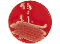 Foto — Zeltainā stafilokoka diagnostika © iStockphoto