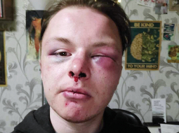 Pēc uzbrukuma.
Foto no personīgā arhīva